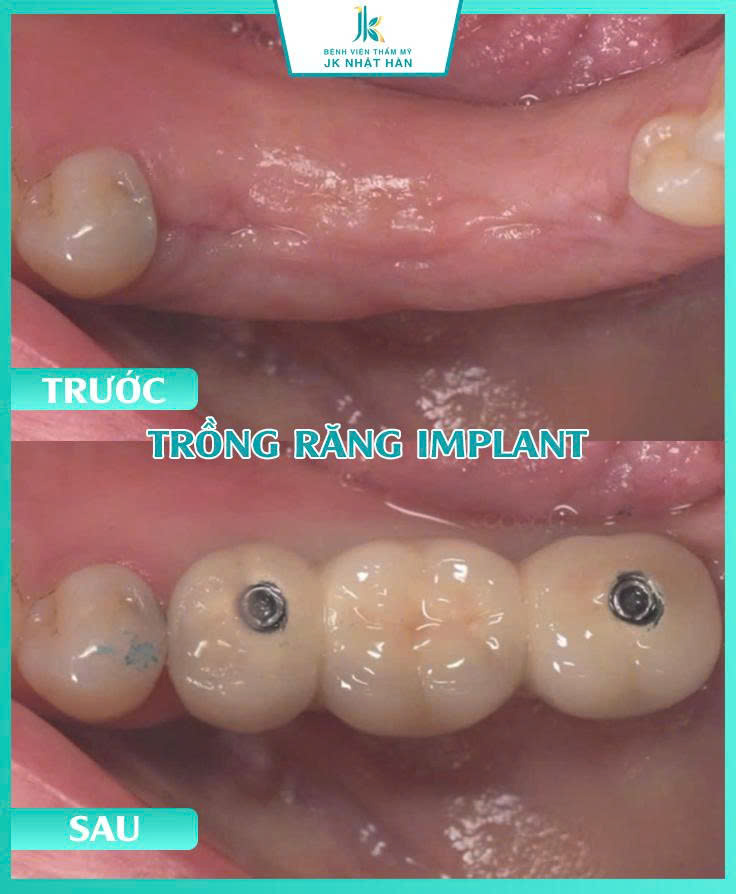 ảnh khách hàng thẩm mỹ nha khoa 10