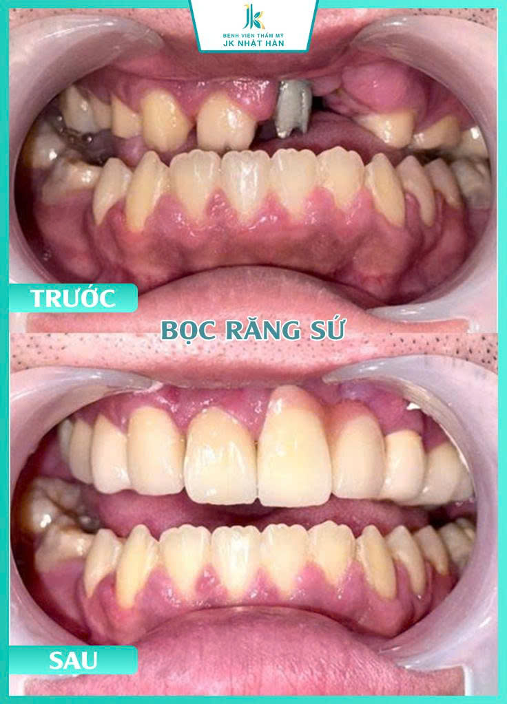 ảnh khách hàng thẩm mỹ nha khoa 5