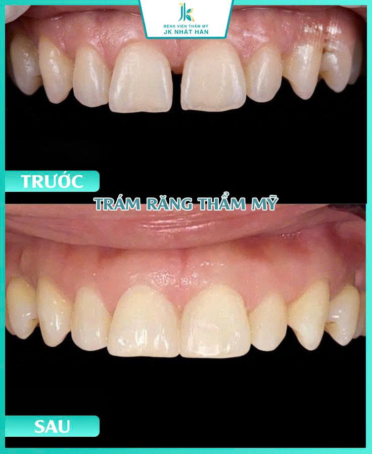 ảnh khách hàng thẩm mỹ nha khoa 6