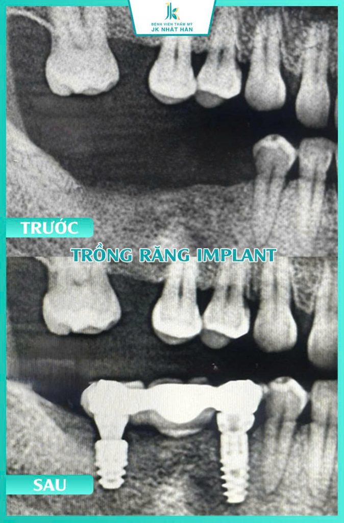 ảnh khách hàng thẩm mỹ nha khoa 7