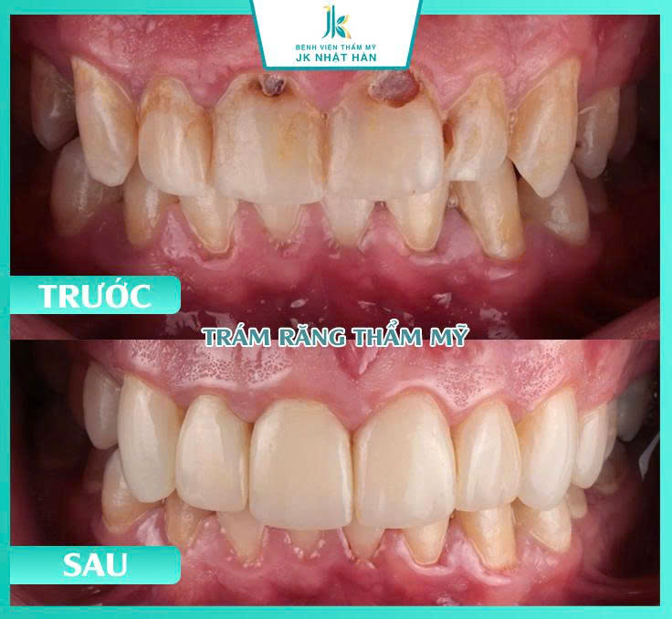 ảnh khách hàng thẩm mỹ nha khoa 9