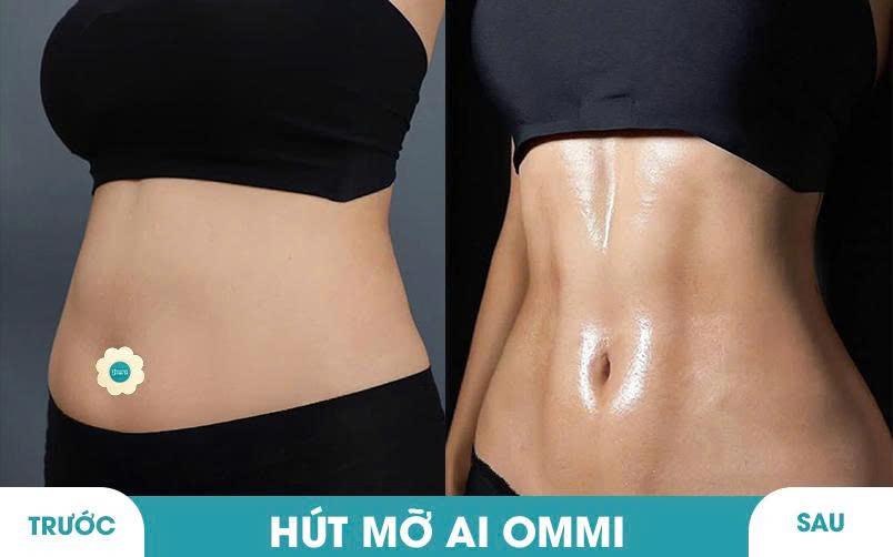 Ảnh khách hàng thẩm mỹ vóc dáng tại JK Nhật Hàn 1