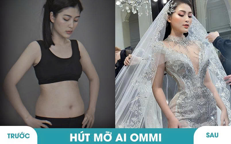 Ảnh khách hàng thẩm mỹ mũi tại JK Nhật Hàn 12