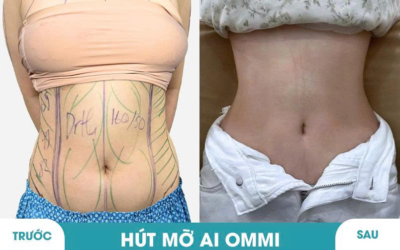 Ảnh khách hàng thẩm mỹ vóc dáng tại JK Nhật Hàn 3