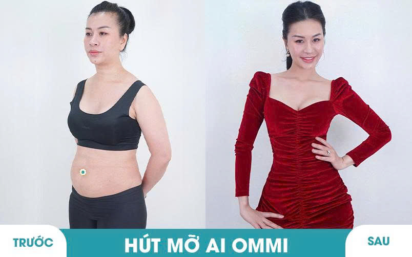 Ảnh khách hàng thẩm mỹ vóc dáng tại JK Nhật Hàn 4