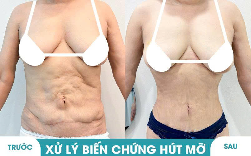 Ảnh khách hàng thẩm mỹ vóc dáng tại JK Nhật Hàn 5