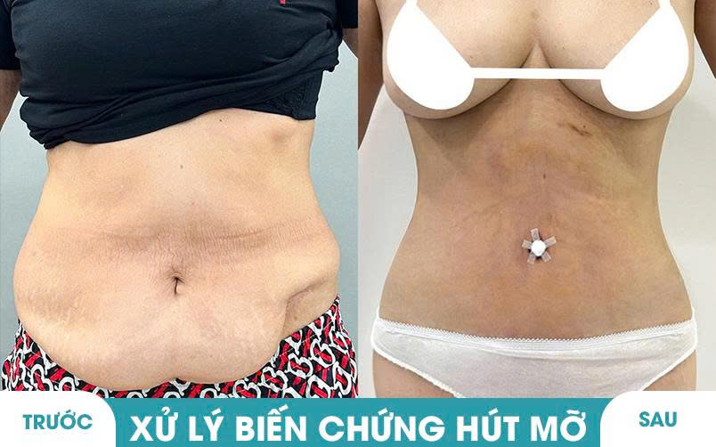 Ảnh khách hàng thẩm mỹ vóc dáng tại JK Nhật Hàn 6