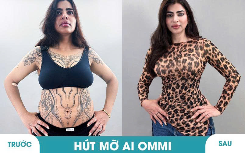 Ảnh khách hàng thẩm mỹ vóc dáng tại JK Nhật Hàn 8