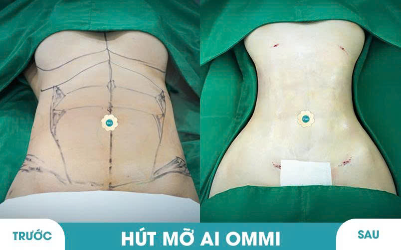 Ảnh khách hàng thẩm mỹ vóc dáng tại JK Nhật Hàn 9