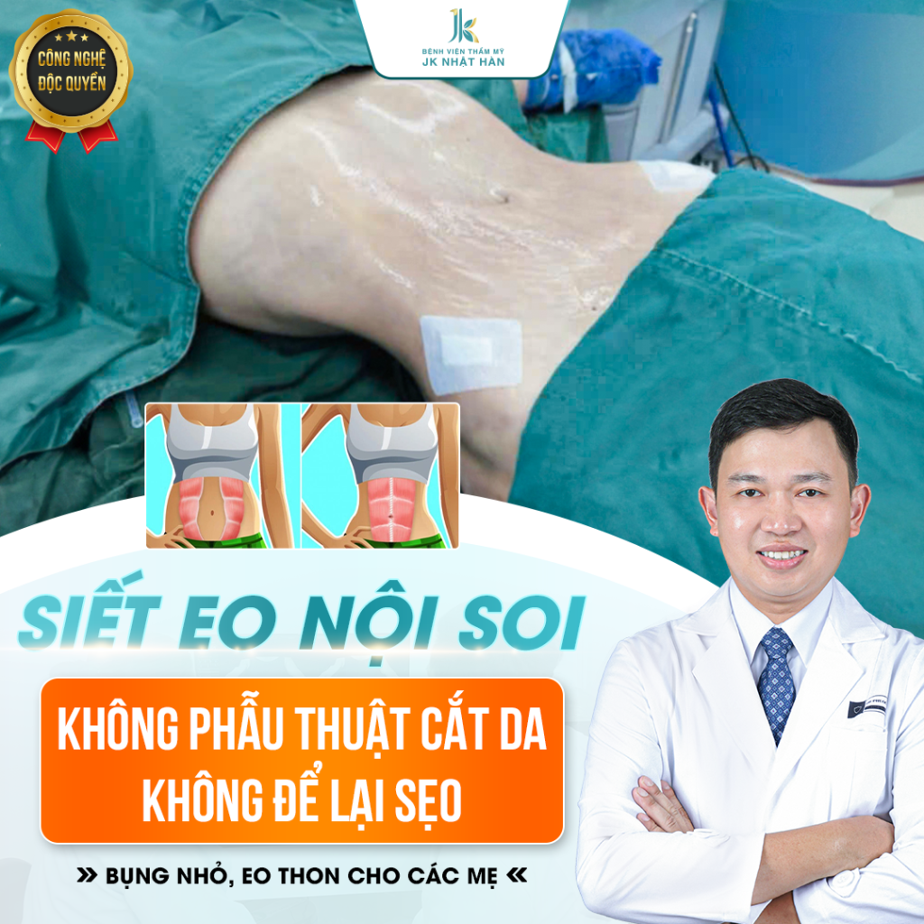 Tạo hình thành bụng nội soi Ommi