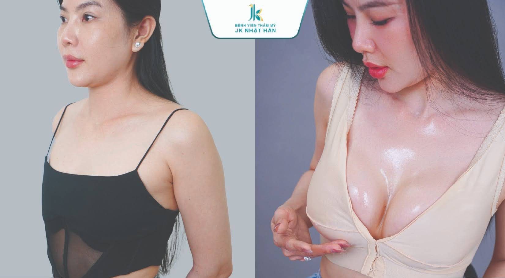 túi ngực Ergonomix 2 1