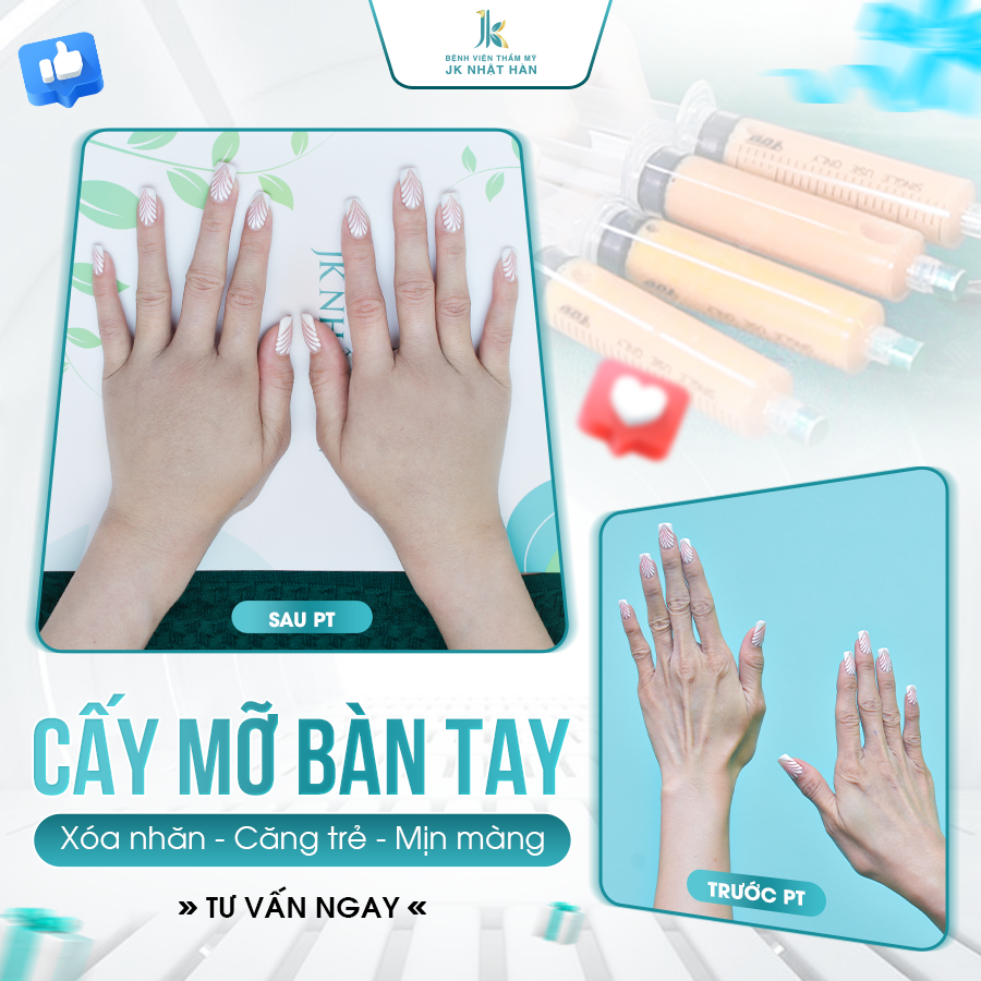https://benhvienthammyjknhathan.com/cay-mo-ban-tay-giai-phap-tre-hoa/