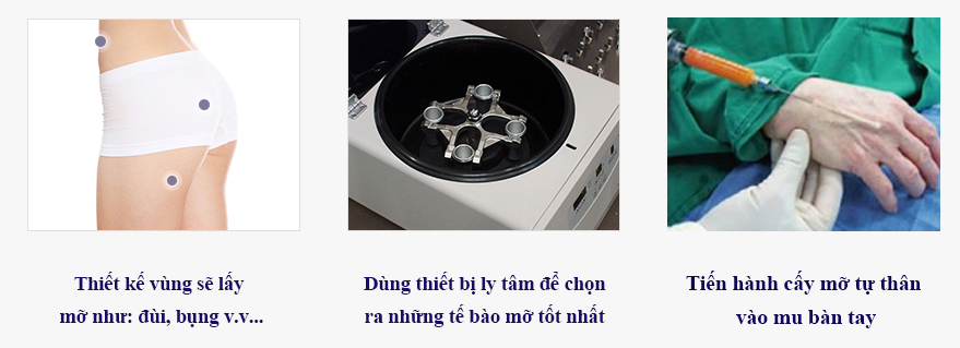 https://benhvienthammyjknhathan.com/cay-mo-ban-tay-giai-phap-tre-hoa-tu-nhien/