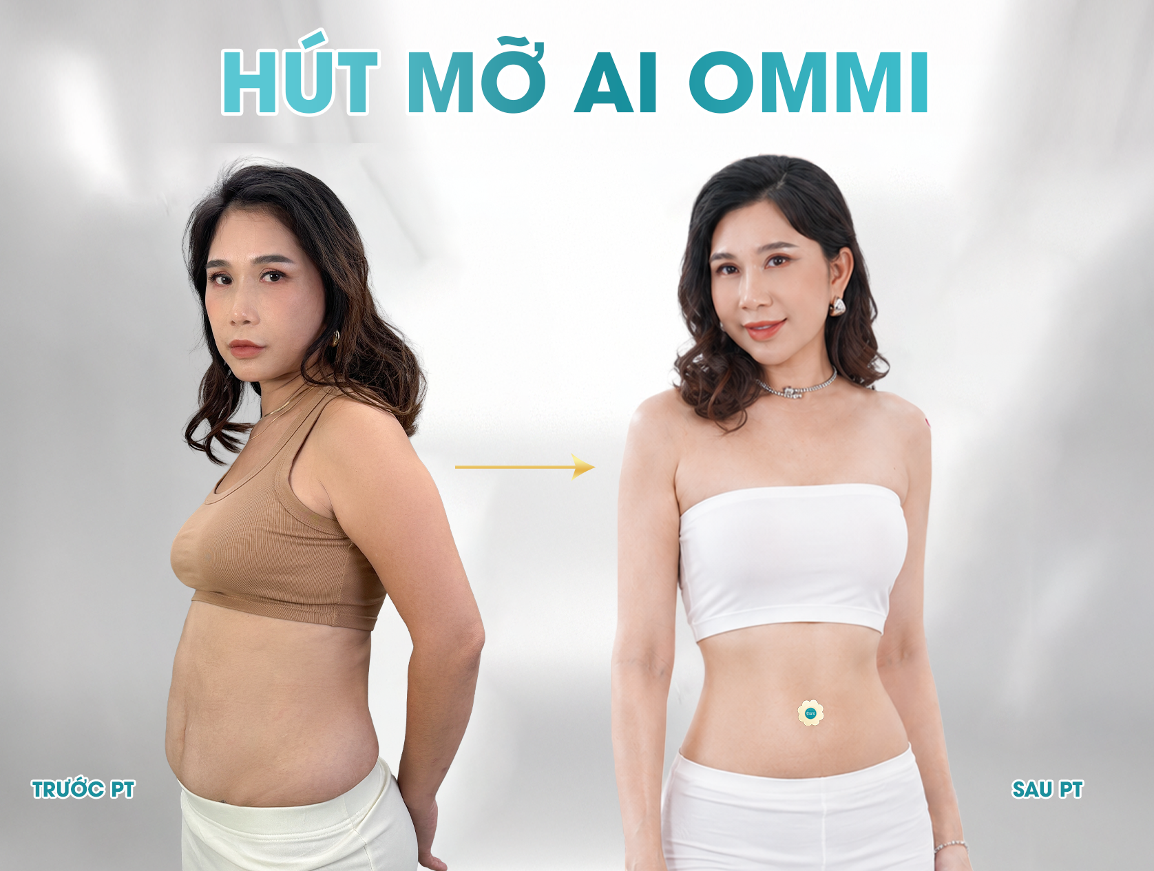 Hình ảnh một số khách hàng thực hiện Hút mỡ AI Ommi tại JK Nhật Hàn