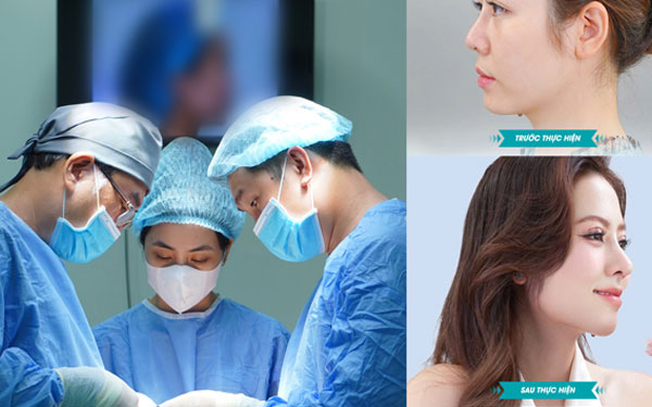 Xóa mũi tẹt thanh thiếu niên Việt eva.vn