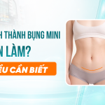 Tạo Hình Thành Bụng Mini Là Gì? 8 Điều Cần Biết Trước Khi Thực Hiện