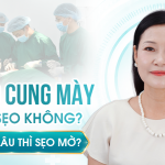Treo Cung Mày Có Sẹo Không? Bao Lâu Thì Sẹo Mờ?
