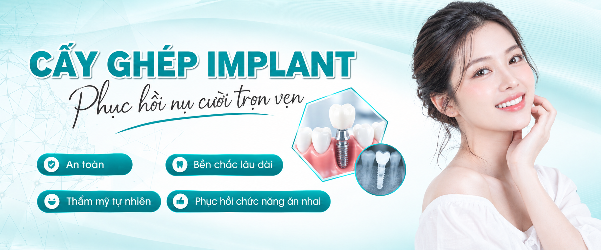 Cấy ghép implant - JK Nhật Hàn